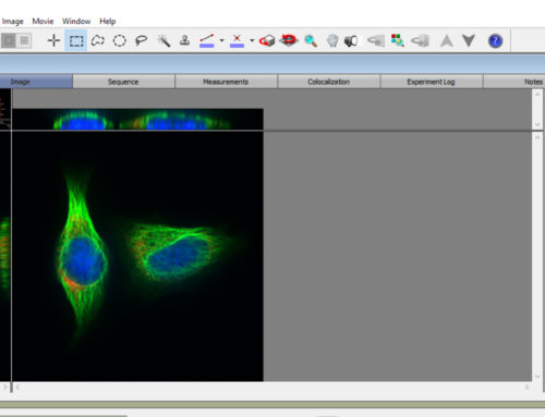 Volocity image acquisition and analysis